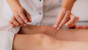 h5-rev-img-2-300x169 Acupuncture for joint pain Cairns