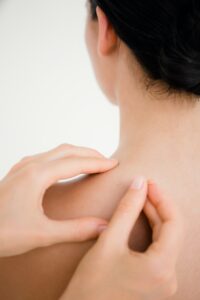 close-up-view-of-woman-holding-a-needle-in-an-acupuncture-therapy-200x300 Acupuncture for injury recovery Cairns